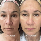 PDRN Anti-Age Cream