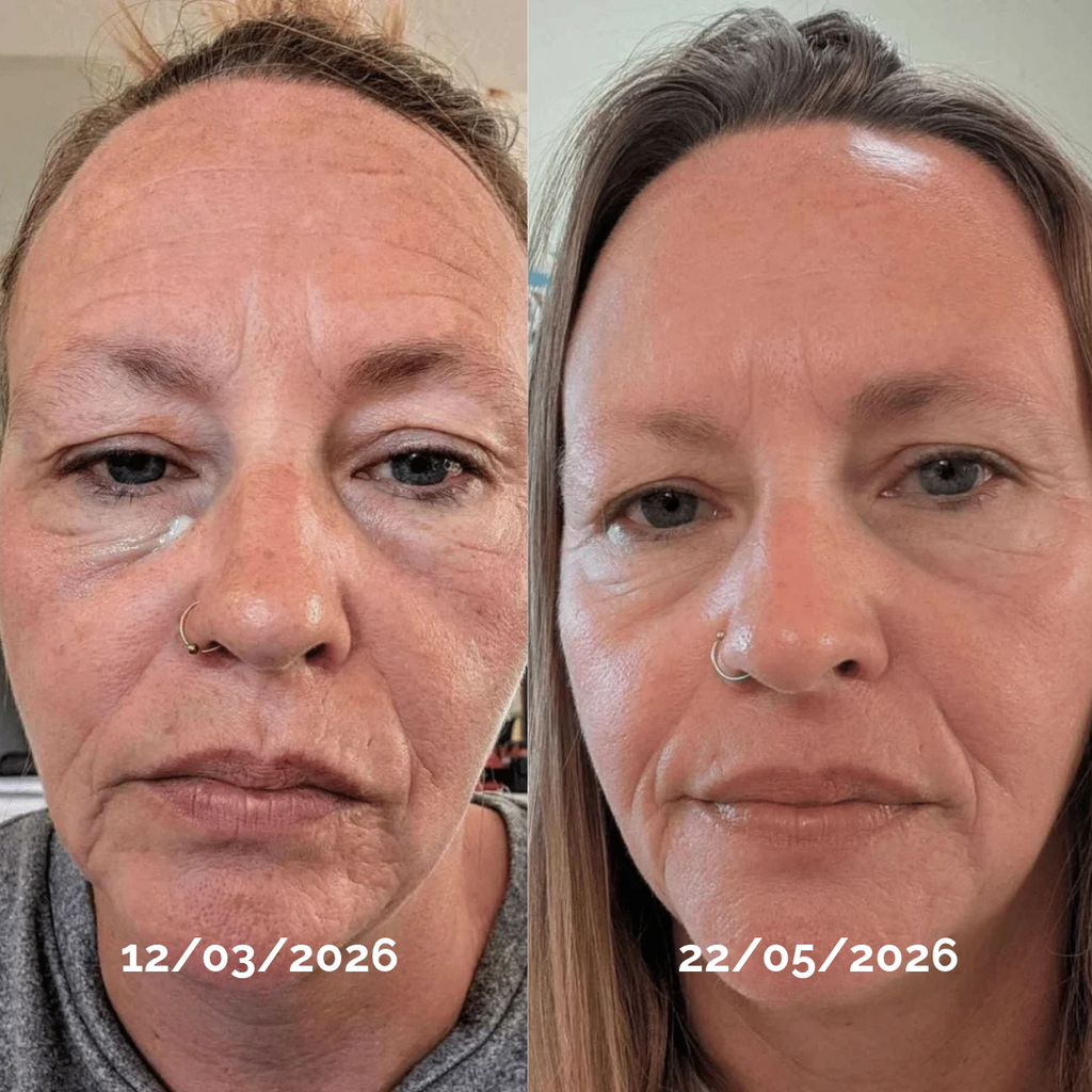 PDRN Anti-Age Cream